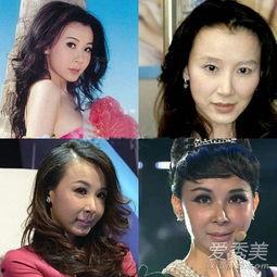 明星整容孩子丑,孩子颜值是否受影响？